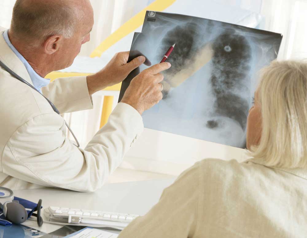 Quels sont les médecins de pneumologie